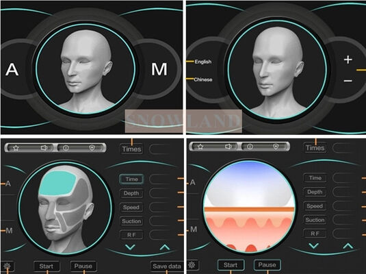 Semiconductor 808nm Laser Diode Laser Hair Removal Machine Met Huid Contact Sensor Zorg voor een snelle Hair Removal behandeling