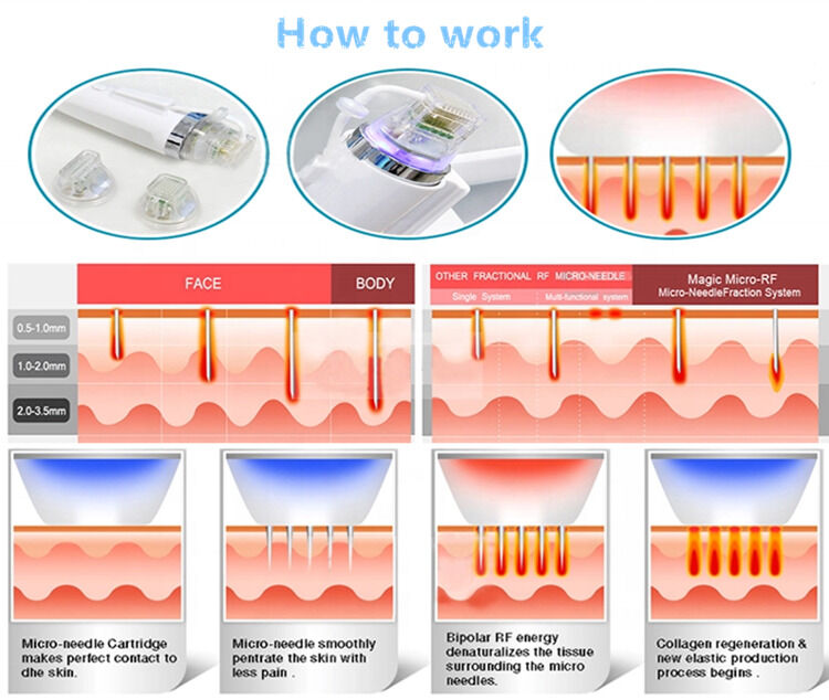 64 58 53CM Diode Laser Ontharing Machine Aantal 1 Snelle Ontharing Functie Professioneel Apparaat voor Kliniek en Spa